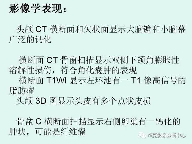 【PPT】痣样基底细胞癌综合征