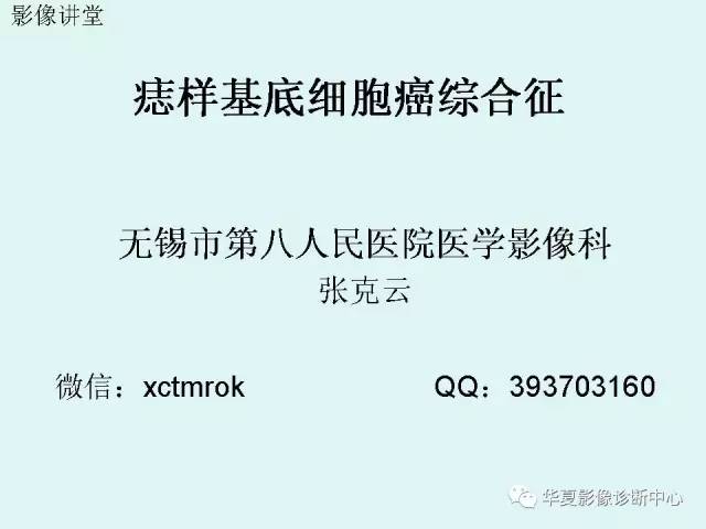 【PPT】痣样基底细胞癌综合征