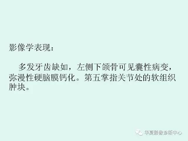 【PPT】痣样基底细胞癌综合征