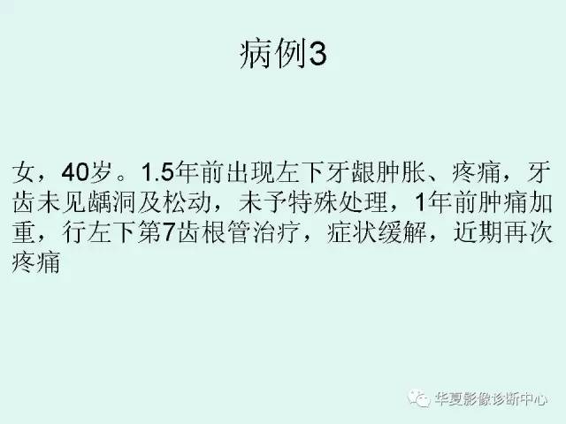 【PPT】痣样基底细胞癌综合征