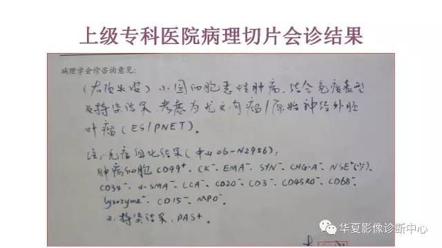 【病例】右顶部尤文氏肉瘤1例