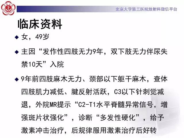 【病例】视神经脊髓炎1例MR影像表现分析