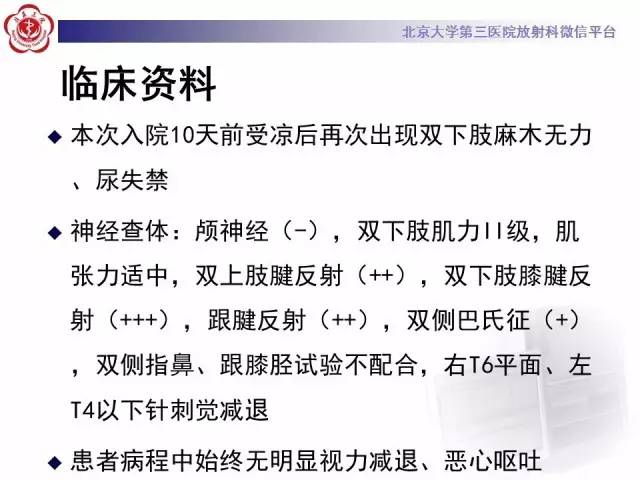 【病例】视神经脊髓炎1例MR影像表现分析