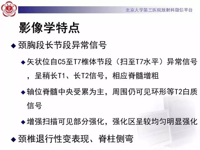 【病例】视神经脊髓炎1例MR影像表现分析