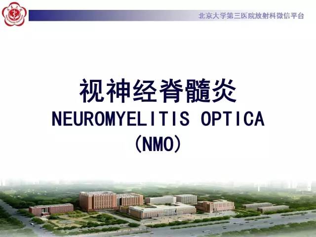 【病例】视神经脊髓炎1例MR影像表现分析