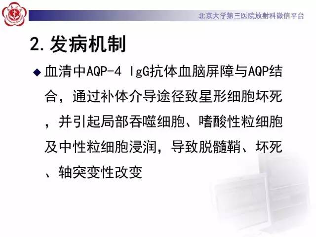 【病例】视神经脊髓炎1例MR影像表现分析