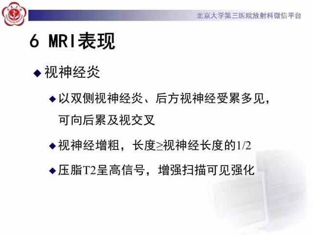 【病例】视神经脊髓炎1例MR影像表现分析