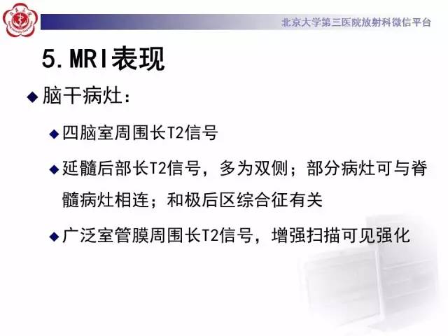 【病例】视神经脊髓炎1例MR影像表现分析