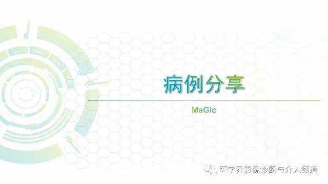 【病例】白血病粒细胞肉瘤1例MR影像表现