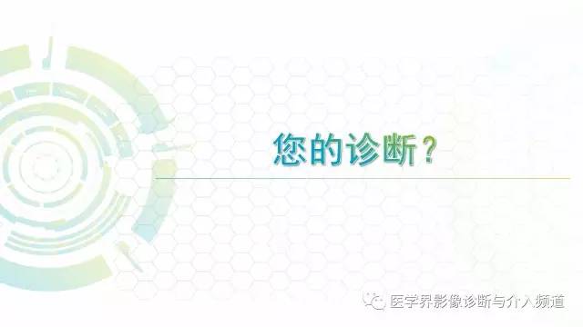 【病例】白血病粒细胞肉瘤1例MR影像表现