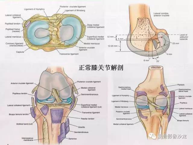 【PPT】骨骼肌肉系统疾病MRI诊断基础
