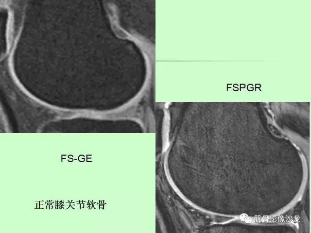 【PPT】骨骼肌肉系统疾病MRI诊断基础