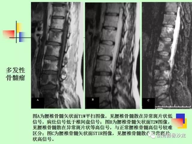 【PPT】骨骼肌肉系统疾病MRI诊断基础