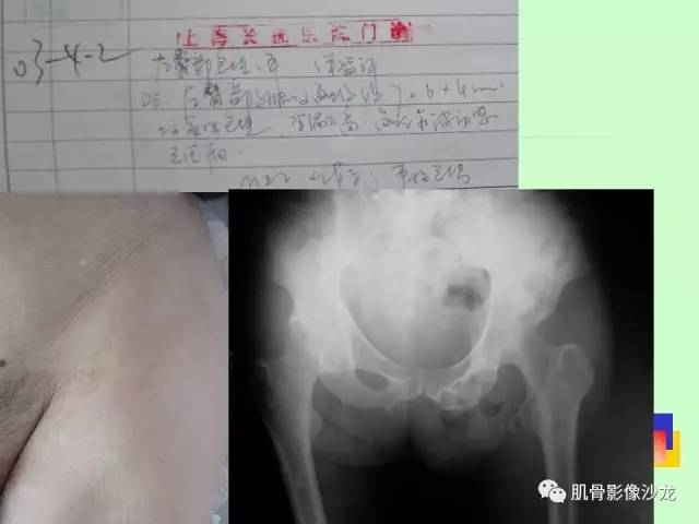 【PPT】骨骼肌肉系统疾病MRI诊断基础