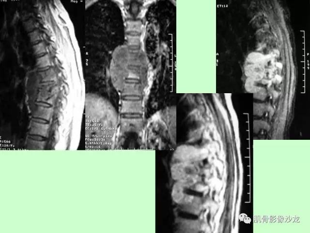 【PPT】骨骼肌肉系统疾病MRI诊断基础