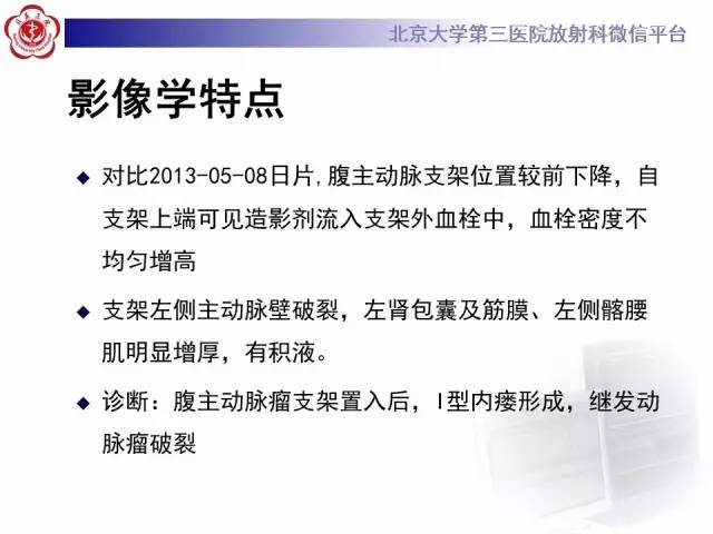 【病例】主动脉腔内修复术后并发症——内漏1例CT