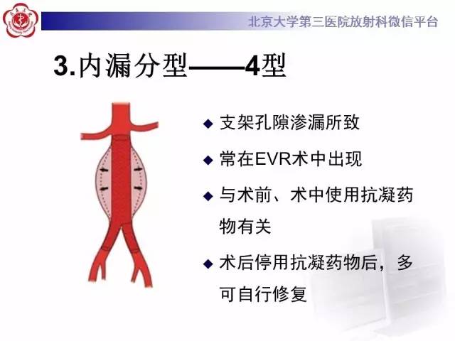 【病例】主动脉腔内修复术后并发症——内漏1例CT