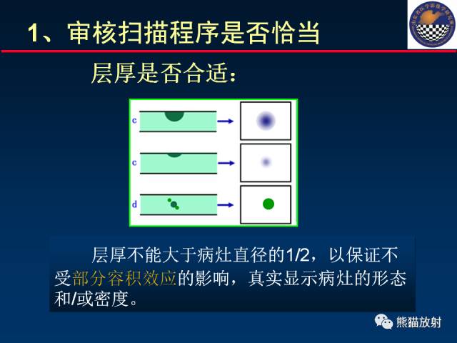 【PPT】影像诊断流程质量控制的重点在哪里？——从CT报告谈起