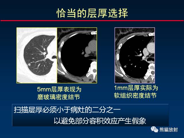 【PPT】影像诊断流程质量控制的重点在哪里？——从CT报告谈起