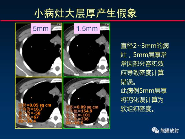 【PPT】影像诊断流程质量控制的重点在哪里？——从CT报告谈起