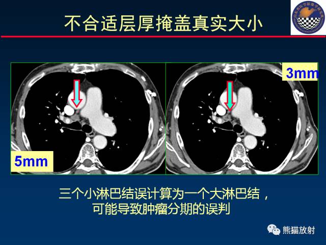 【PPT】影像诊断流程质量控制的重点在哪里？——从CT报告谈起