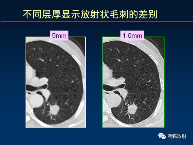 【PPT】影像诊断流程质量控制的重点在哪里？——从CT报告谈起