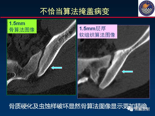 【PPT】影像诊断流程质量控制的重点在哪里？——从CT报告谈起