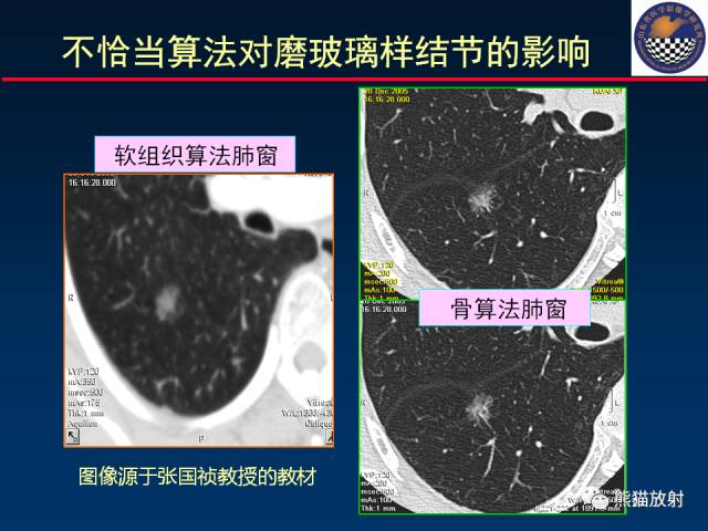 【PPT】影像诊断流程质量控制的重点在哪里？——从CT报告谈起