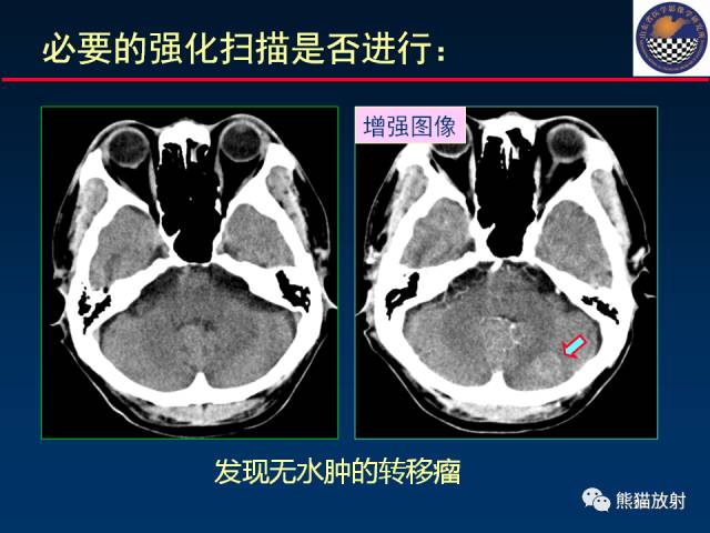 【PPT】影像诊断流程质量控制的重点在哪里？——从CT报告谈起