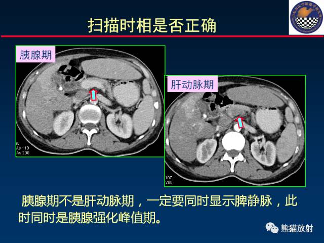 【PPT】影像诊断流程质量控制的重点在哪里？——从CT报告谈起