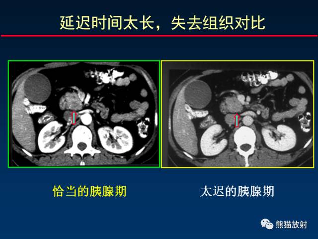 【PPT】影像诊断流程质量控制的重点在哪里？——从CT报告谈起