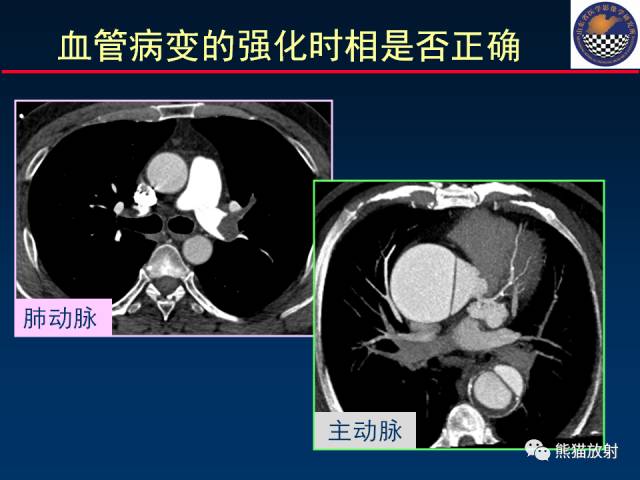 【PPT】影像诊断流程质量控制的重点在哪里？——从CT报告谈起