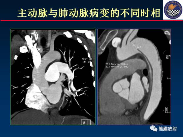 【PPT】影像诊断流程质量控制的重点在哪里？——从CT报告谈起