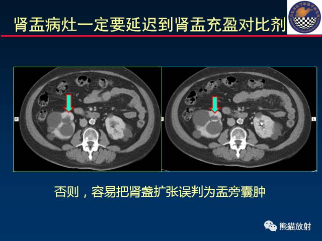 【PPT】影像诊断流程质量控制的重点在哪里？——从CT报告谈起