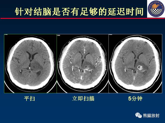 【PPT】影像诊断流程质量控制的重点在哪里？——从CT报告谈起