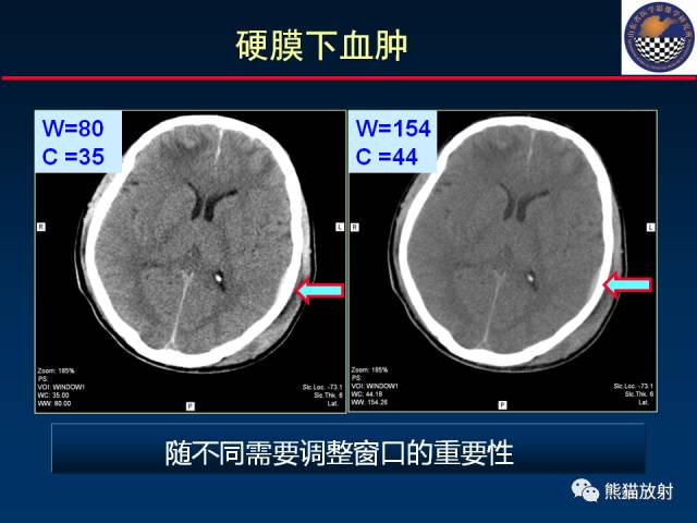 【PPT】影像诊断流程质量控制的重点在哪里？——从CT报告谈起