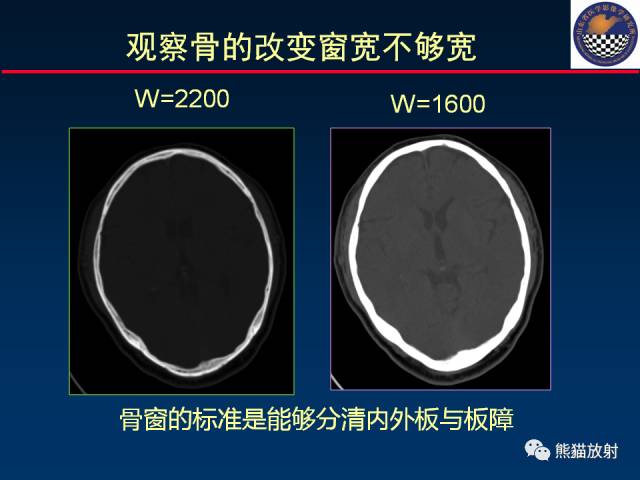 【PPT】影像诊断流程质量控制的重点在哪里？——从CT报告谈起