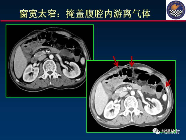 【PPT】影像诊断流程质量控制的重点在哪里？——从CT报告谈起