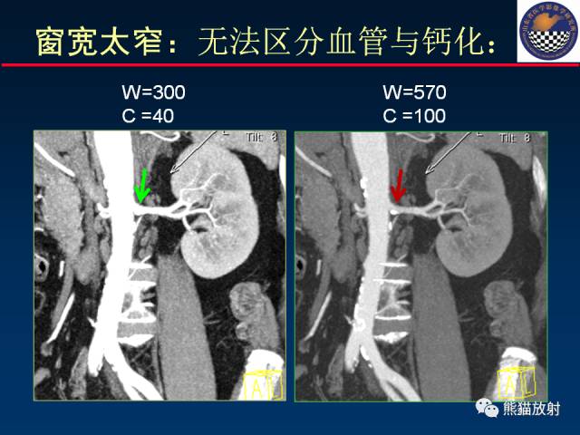 【PPT】影像诊断流程质量控制的重点在哪里？——从CT报告谈起