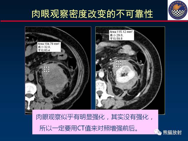 【PPT】影像诊断流程质量控制的重点在哪里？——从CT报告谈起