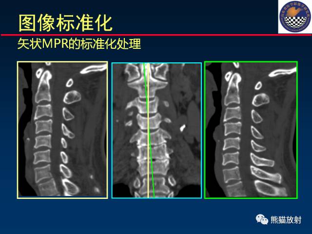 【PPT】影像诊断流程质量控制的重点在哪里？——从CT报告谈起
