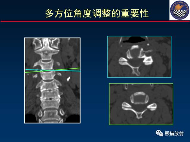 【PPT】影像诊断流程质量控制的重点在哪里？——从CT报告谈起