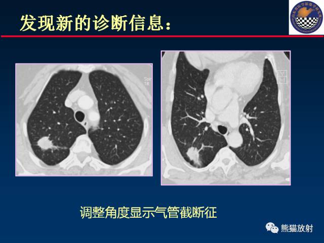 【PPT】影像诊断流程质量控制的重点在哪里？——从CT报告谈起
