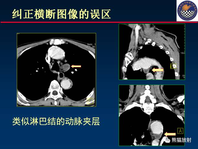 【PPT】影像诊断流程质量控制的重点在哪里？——从CT报告谈起