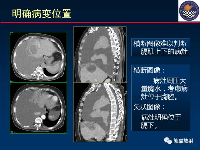 【PPT】影像诊断流程质量控制的重点在哪里？——从CT报告谈起