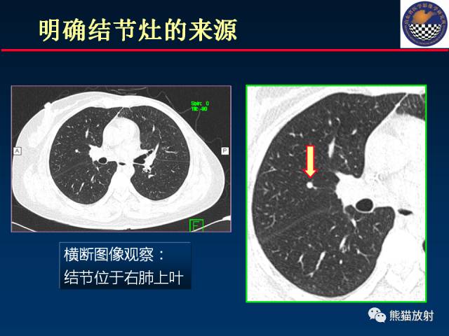 【PPT】影像诊断流程质量控制的重点在哪里？——从CT报告谈起