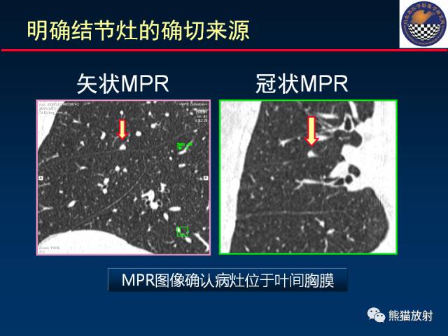 【PPT】影像诊断流程质量控制的重点在哪里？——从CT报告谈起