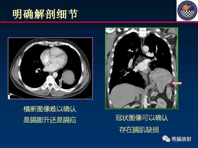 【PPT】影像诊断流程质量控制的重点在哪里？——从CT报告谈起