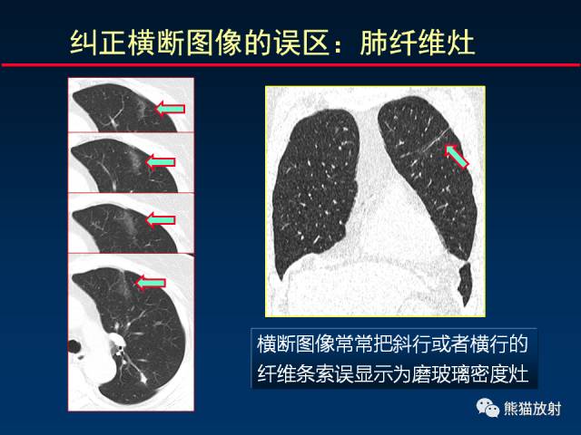 【PPT】影像诊断流程质量控制的重点在哪里？——从CT报告谈起