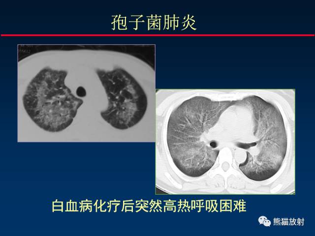 【PPT】影像诊断流程质量控制的重点在哪里？——从CT报告谈起